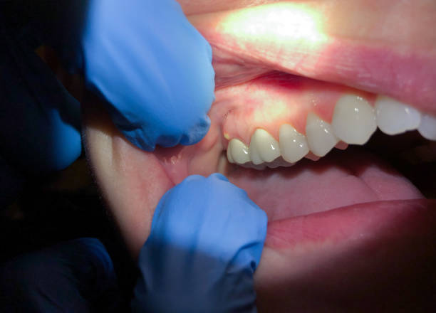 Best Emergency Care for Gum Disease in Lordsburg, NM